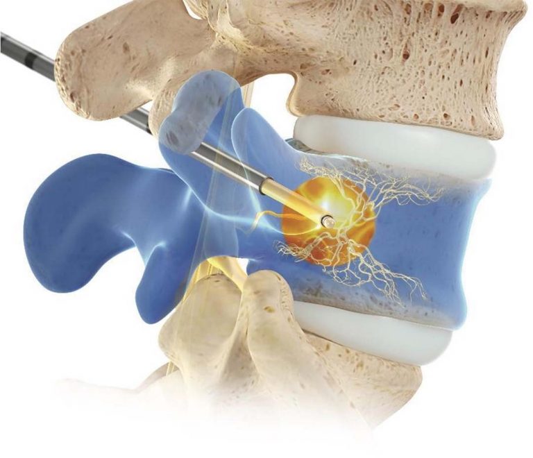 Axis Spine Center - Spine Care & Pain Management in the Northwest