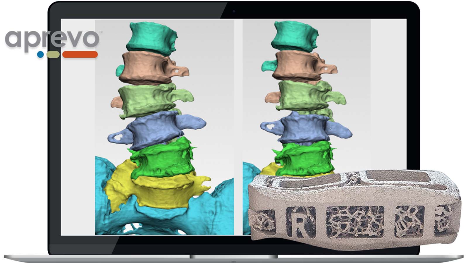 Neuromodulation (SCS/PNS) - Axis Spine Center